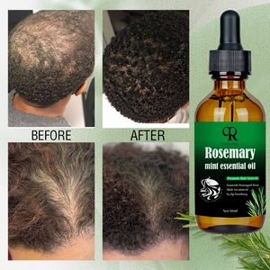 100% doğal formülü besleyici kafa derisi Elixir biberiye yağı saç bakımı kaybı tedavisi saç büyüme yağı serumu - Product Image 4