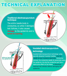 Máquina elétrica da eletrólise do depilador do dispositivo eletrolítico permanente da remoção do cabelo com o <span class=keywords><strong>Needle</strong></span>-10pcs para a remoção branca do cabelo - Product Image 4