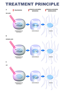 כיתה 4 אינפרא אדום 945nm 650nm 650nm כאב מלא גוף מלא כאב לייזר lumbar עמוד השדרה lt - Product Image 6
