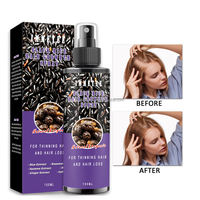 Semprotan Air Beras Hitam Logo Kustom untuk Pertumbuhan Rambut 150ml Ekstrak Jahe Wijen Alami Serum Perawatan Kulit Kepala Anti-Rontok