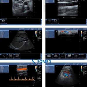 Échographe 2D PC à grand écran, design convivial, pour usage vétérinaire et humain, avec un grand angle de vue, image claire CU09 - Product Image 6