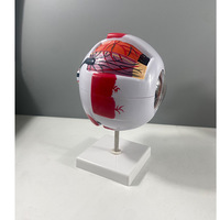 Modèle d'enseignement d'anatomie ophtalmologique XR 6x agrandi pour usage médical, en ABS/PVC