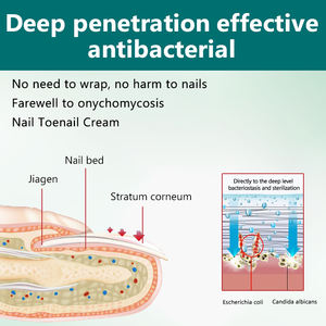 असमान मोटी नाखूनों के लिए रंग की नाखून मरम्मत क्रीम के लिए फंगल ग्रे नाखून मरम्मत क्रीम - Product Image 3