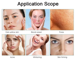 Thérapie par la lumière PDT, rajeunissement de la peau, thérapie de beauté, photothérapie pour l'acné du <span class=keywords><strong>visage</strong></span>, élimination des rides, soin de la peau et appareil de beauté - Product Image 6