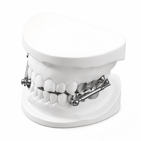 Ortodontik Herbst Cihazı Özel Yapım Mandibular Anterior Yeniden Konumlandırma Cihazı Derin Aşırı Diş Çıkması Düzeltmesi İçin