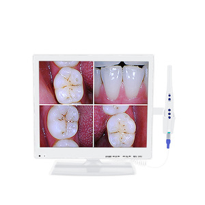 Endoscopio Dental con Wifi, Toma de Fotos, Monitor de Alta Definición de 17 Pulgadas, Escáner Intraoral Médico - Product Image 3