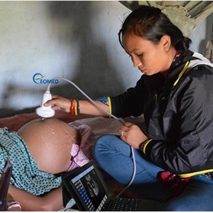 Sonde linéaire à 128 éléments 7,5/10 MHz pour échographie vétérinaire et humaine, portable sans fil, USB/Wi-Fi CU07, CU08 – Approvisionnement direct - Product Image 6