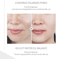 Appareil portable de nettoyage en profondeur du visage à bulles, jet peel, hydrodermabrasion, rajeunissement de la peau, blanchiment, exfoliation