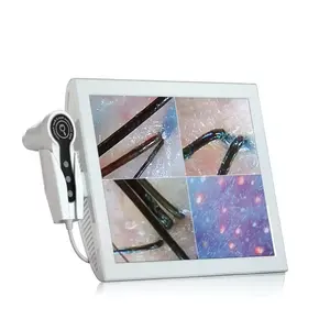 Skin And Hair Analyser Detector Multi-function Skin Analyzer Hair Follicle Scalp Detector With 15 Inch Screen