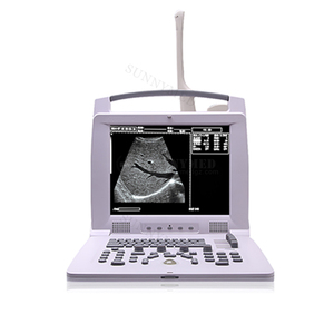 SY-A005 Portable <strong>Cheap</strong> Vet <strong>Ultrasound</strong> Animal <strong>Ultrasound</strong> Scanner <strong>Ultrasound</strong> <strong>Machine</strong> With Internal Printer - Product Image 1