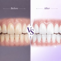 Dentifrice Blanchissant Herbal Anti-Caries OEM ODM Marque Privée Emballage Personnalisé Menthe Naturelle Dents Sensibles Souffle Frais Maison