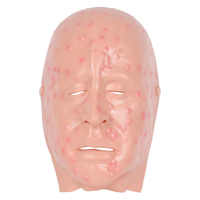 Masque anatomique en PVC pour démonstration de lésion faciale de la variole légère, pour l'enseignement scolaire avec simulation humaine réaliste