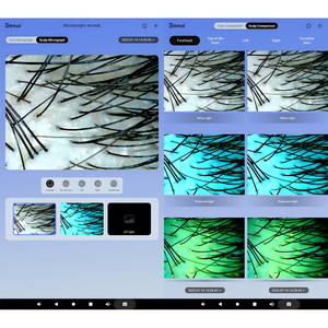 Dernière technologie 2 en 1 Détecteur de numérisation du cuir chevelu et des cheveux Analyseur de peau 3D IA Machine d'analyse de la peau du visage - Product Image 4