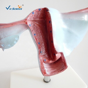 แบบจำลองมดลูกธรรมชาติ แบบจำลองมดลูก แบบจำลองมดลูกทางกายวิภาค - Product Image 6