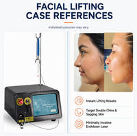 Machine de lipolyse au laser diode 1470 nm pour chirurgie plastique, liposuccion Vaser, endolaser, lifting du visage