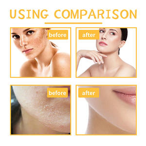 Private Label Natürliches Bio-Aufhellendes Körperpeeling, Exfolierend, Bleichend, Entfernt Dunkle Flecken, Kurkuma-Peeling für Gesicht und Körper - Product Image 5