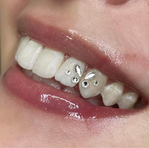 Bellezza diamante farfalla dentaria cristallo gioielli gioielli cristalli pietra dente gemma sorriso splendido - Product Image 2