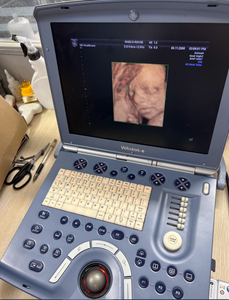 Fourniture et réparation de la machine à ultrasons portable Voluson e VolusonE Voluson.e - Product Image 5