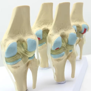 SCIEDU articulation du genou <span class=keywords><strong>squelette</strong></span> ressource pédagogique médical <span class=keywords><strong>humain</strong></span> 4 étapes modèle d'articulation du genou avec carte arrière modèle d'articulation du genou malade - Product Image 5