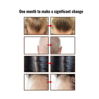 Acondicionador Hidratante con Biotina de Marca Privada para el Crecimiento, Fortalecimiento y Reparación del Cabello para Uso Diario