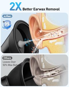 Herramienta Eléctrica para Remover Cera de Oídos, Dispositivo de Limpieza de Oídos con Sistema de Separación de Agua para Cuidado Personal - Product Image 2