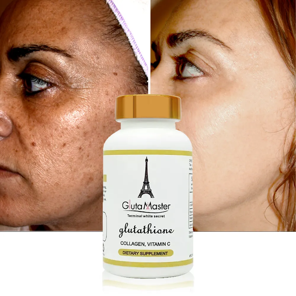 Comprimé de blanchiment de pilules de dissolvant de points noirs blanchissant la peau capsule de glutathion éclaircissant la peau blanchissant des pilules pour la peau noire