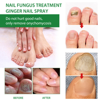 Nouvel Arrivage 2025 Traitement Anti-Champignons des Ongles en Spray en 7 Jours Répare les Ongles Abîmés et les Cuticules Soins de la Peau 30ml Spray Ongles MOOYAM