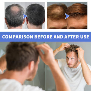 OUHOE Haute qualité Nettoyage en profondeur Réparation <span class=keywords><strong>Racine</strong></span> des <span class=keywords><strong>cheveux</strong></span> Follicule pileux Soin hydratant <span class=keywords><strong>Mousse</strong></span> pour <span class=keywords><strong>cheveux</strong></span> pour hommes 60ml - Product Image 4