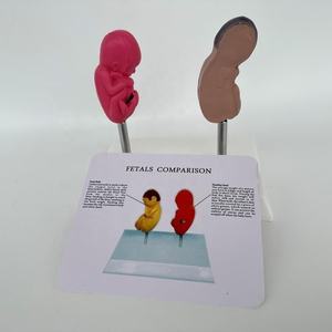 Comparaison des sciences médicales Modèle de maladie de pathologie de malformation fœtale humaine Modèle de maladie d'organe Modèle anti-drogue - Product Image 4