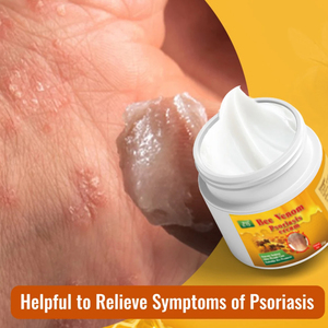 ZB <span class=keywords><strong>Eczéma</strong></span> Baume Antibactérien Crème Antiprurigineuse À Base De Plantes Érythème Prurit Dermatite Démangeaisons Psoriasis Pommade 20g - Product Image 5