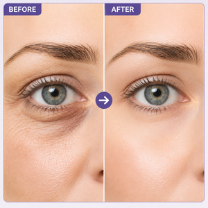 Gel liftant instantané OEM pour les yeux, sérum raffermissant et tenseur anti-âge, réduit les rides, les poches et les cernes, marque privée - Product Image 4