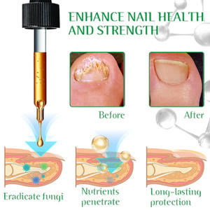 Suero nutritivo para el crecimiento del cabello, cuidado del cuero cabelludo, menta Romero, aceite esencial para el cabello, 60ml - Product Image 5
