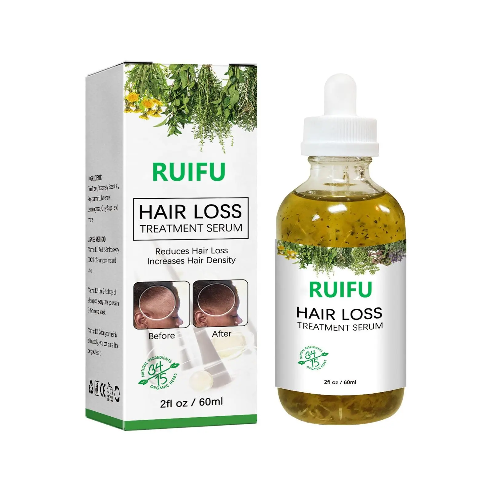 Private Label Natural Organic Rosemary Castor Almond Oil Men Women Scalp Care Serum Hair Treatment Growth Oil