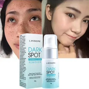 Dehnung streifen entfernung Entfernen Sie Sommersprossen haut Helles Gesicht Dark Spot Cream