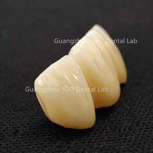 Couronnes en zircone solide avec <span class=keywords><strong>porcelaine</strong></span> Built-up Full Service China Dental Lab <span class=keywords><strong>Prix</strong></span> - Product Image 2