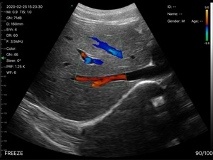 Sonda Inalámbrica DMU36 Convexa, Ecógrafo Doppler Color de 128 Elementos con CF/PW/PDI para Uso Abdominal y Obstétrico - Product Image 6