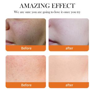 Crema y Loción Facial Premium para Mujer, Blanqueadora e Hidratante con Extracto de Cúrcuma - Product Image 5