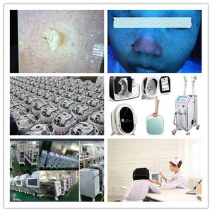 Mesin analisis kulit 3D penganalisa kulit, penguji pori-pori kelembapan detektor kulit profesional - Product Image 3