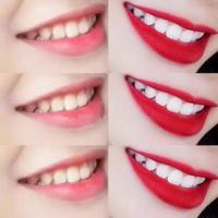 Sistema de blanqueamiento dental profesional 35% CP, Gel blanqueador de dientes blanco brillante, elimina las manchas amarillas
