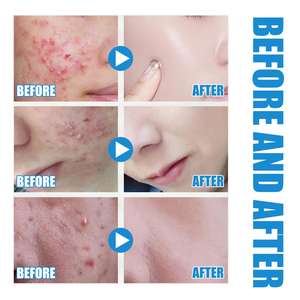 EELHOE Sérum Visage à l'<span class=keywords><strong>Acide</strong></span> Hyaluronique Actif 10ml en Gros Marque Privée Sérum Visage Bio Hydra Sérum Visage Éclaircissant Anti-Âge - Product Image 6