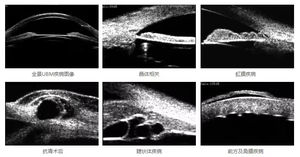 Alat USG Mata Portabel SW-3200S, USG Oftalmik Skala Penuh untuk Pemindaian Mata - Product Image 4