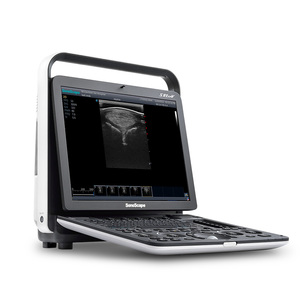 Système d'échographie vétérinaire professionnel Sonoscape S8 ExpV pour des soins hospitaliers complets aux animaux - Product Image 4