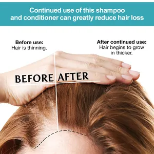 Shampoing Anti-chute au gingembre sans Sulfate, produit de marque privée, biotine, croissance des cheveux