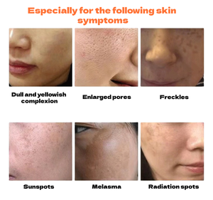 <span class=keywords><strong>Masque</strong></span> Facial Herbal Anti-Points Noirs pour la Zone T, Éliminateur de Taches Sombres, <span class=keywords><strong>Masque</strong></span> <span class=keywords><strong>Peel</strong></span>-<span class=keywords><strong>Off</strong></span> Blanchissant pour Salons de Beauté - Product Image 3