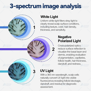 Nuevo Analizador de Cuero Cabelludo 3 en 1 con IA, Modelo 2026, Construcción Metálica, Pantalla Táctil de 15.6 Pulgadas, Multiespectral - Product Image 3