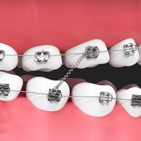 Machine à former des ressorts sans fil pour ressorts orthodontiques et fils de ligature orthodontiques