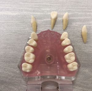 Mô Hình Nhổ Răng Nha Khoa Với Kẹo Cao Su Mềm Và Răng Có Thể Tháo Rời - Product Image 3