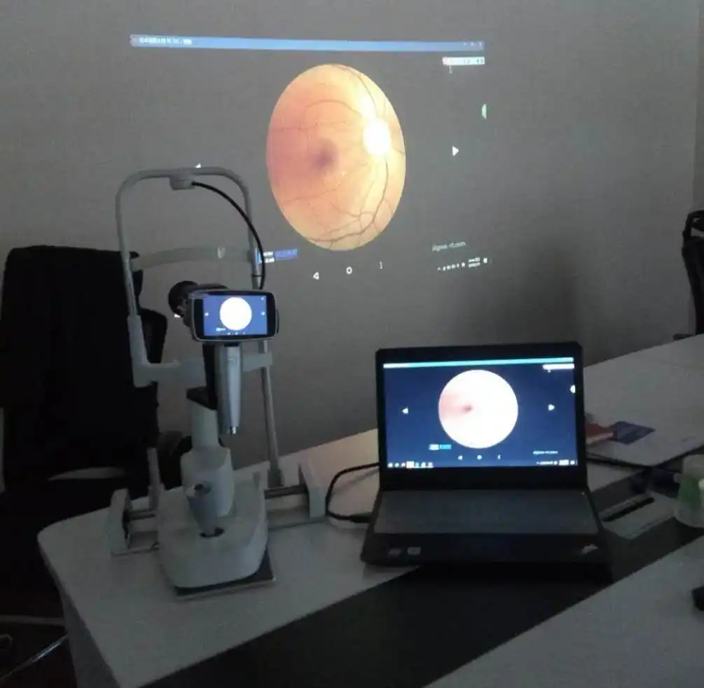 Cámara inteligente portátil para diagnóstico de oftalmologías, dispositivo de cámara para diagnosticar enfermedades de los hongos
