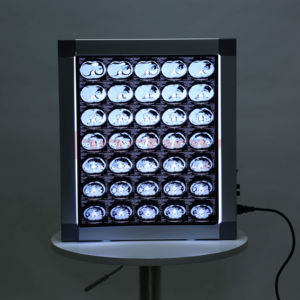 HOCHEY tıbbi hastane görüntüleme kutusu tek <span class=keywords><strong>x</strong></span>-<span class=keywords><strong>ray</strong></span> Film görüntüleyici tek Panel tıbbi <span class=keywords><strong>x</strong></span>-<span class=keywords><strong>ray</strong></span> görüntüleyici kutusu - Product Image 1