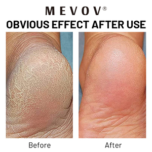 MEVOV Gommage pour les <span class=keywords><strong>pieds</strong></span> à l'arbre à thé, soin exfoliant pour les <span class=keywords><strong>pieds</strong></span> avec huile d'arbre à thé et menthe poivrée, élimine les peaux mortes et les <span class=keywords><strong>callosités</strong></span>, adoucit les <span class=keywords><strong>pieds</strong></span> rugueux - Product Image 5